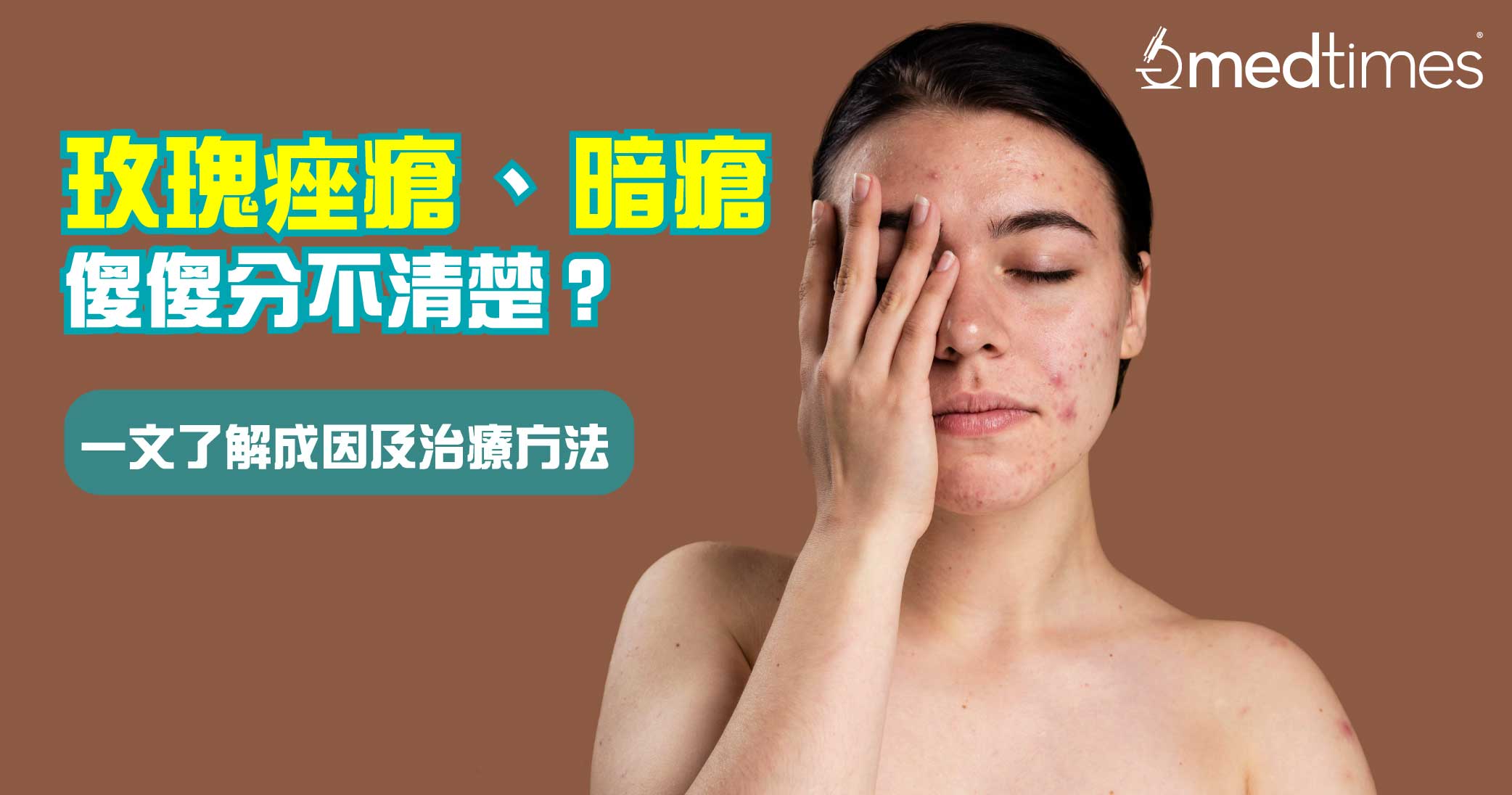 【关注皮肤】玫瑰痤疮与暗疮傻傻分不清楚？了解成因及治疗方法